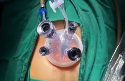 Decryption of Optical and Electronic Technologies of Medical Endoscopes and Their Clinical Applications