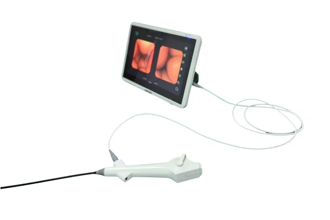 disposable choledochoscope
